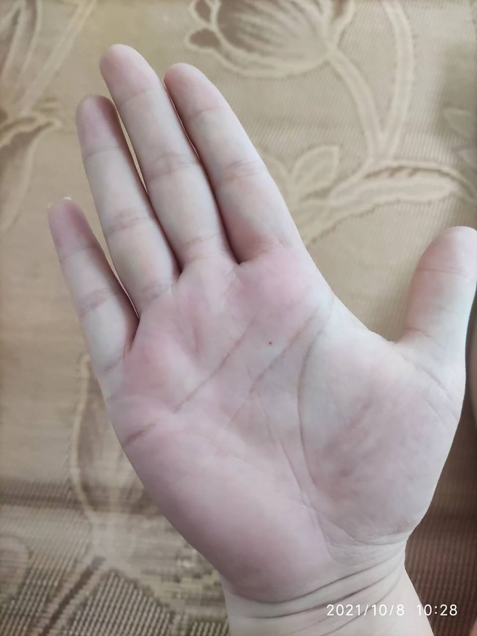 手纹,最近手掌长了个小黑痣 有没有会看手纹的大神来两句