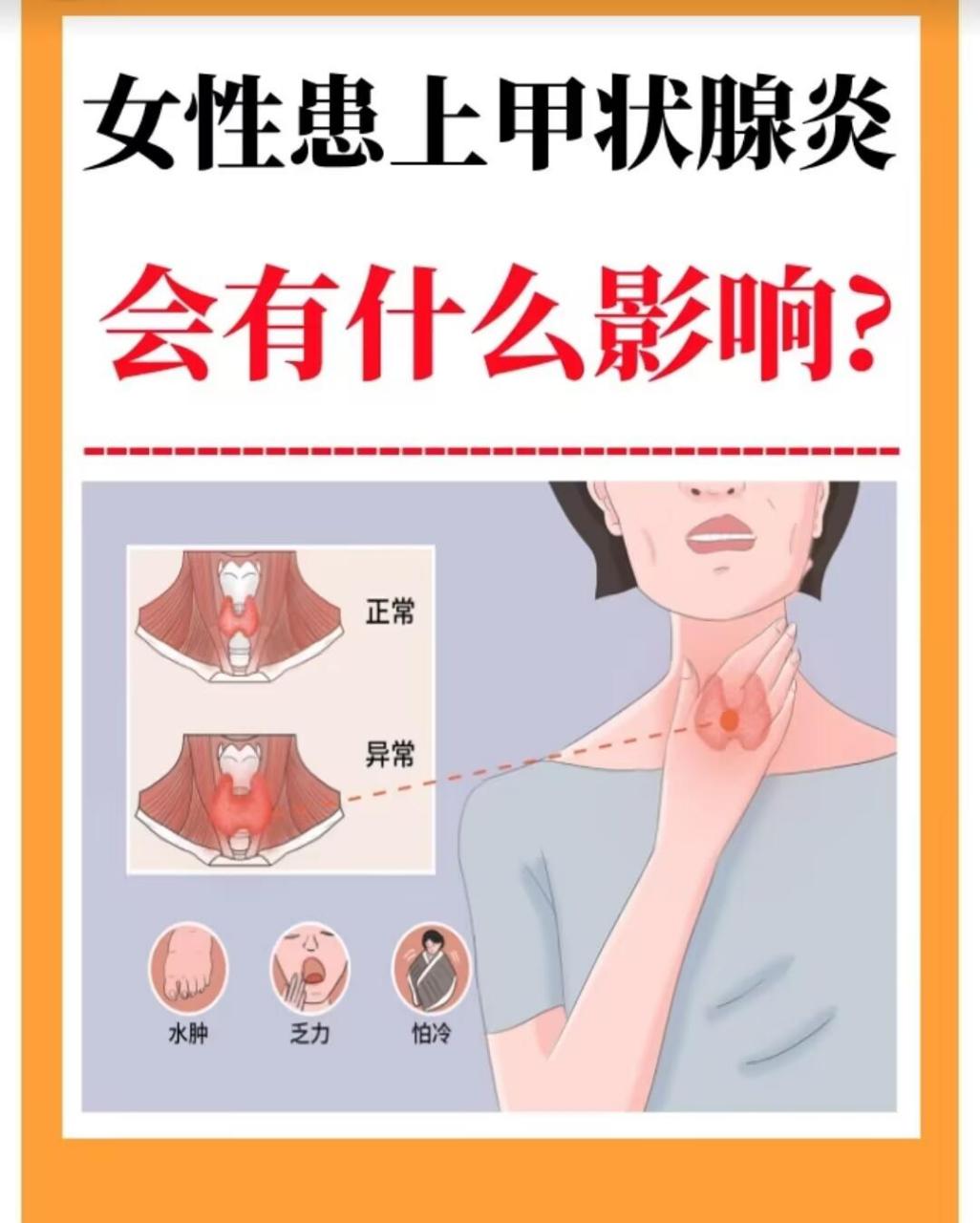 女性甲状腺的前兆图片