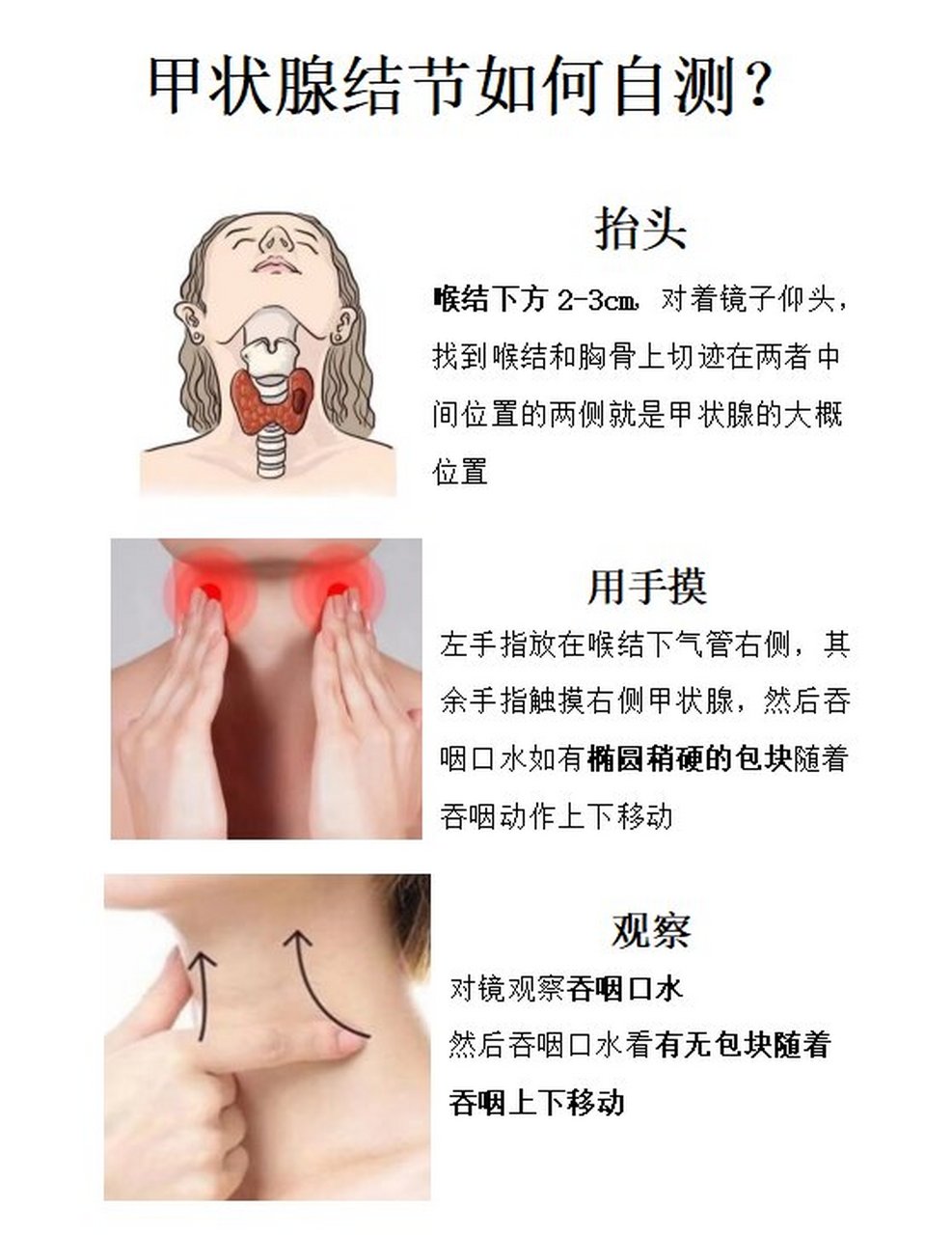 甲状腺自检方法图片