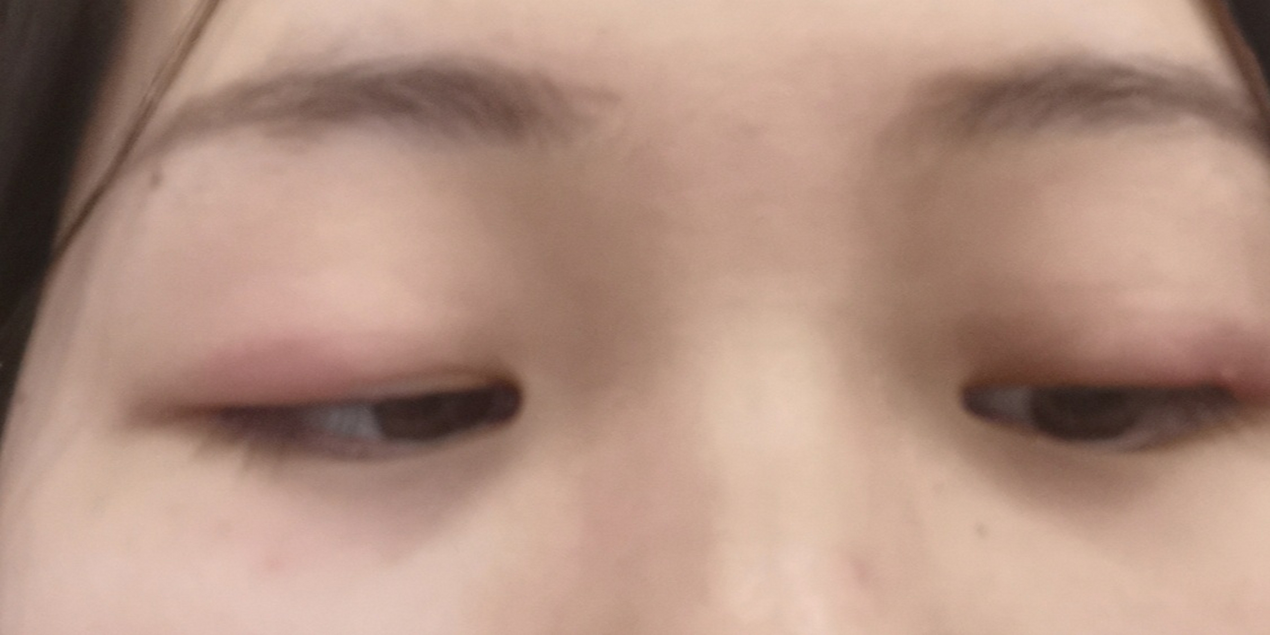 眼皮过敏或者眼炎的一点记录 从一月底左右就开始了眼睛红肿痒,不知道