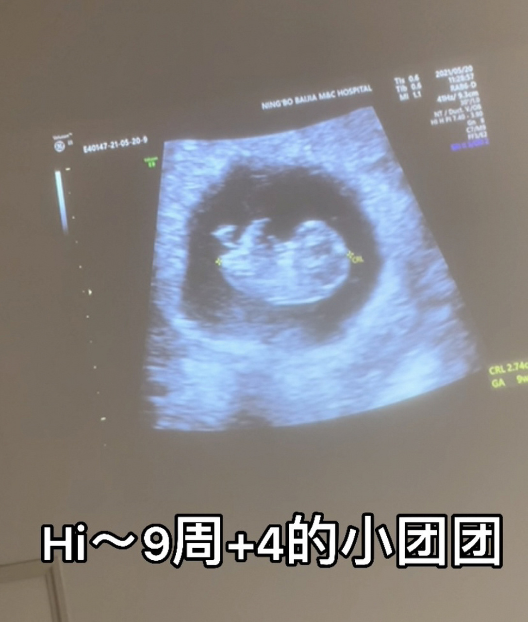 怀孕9周胎儿大小图片