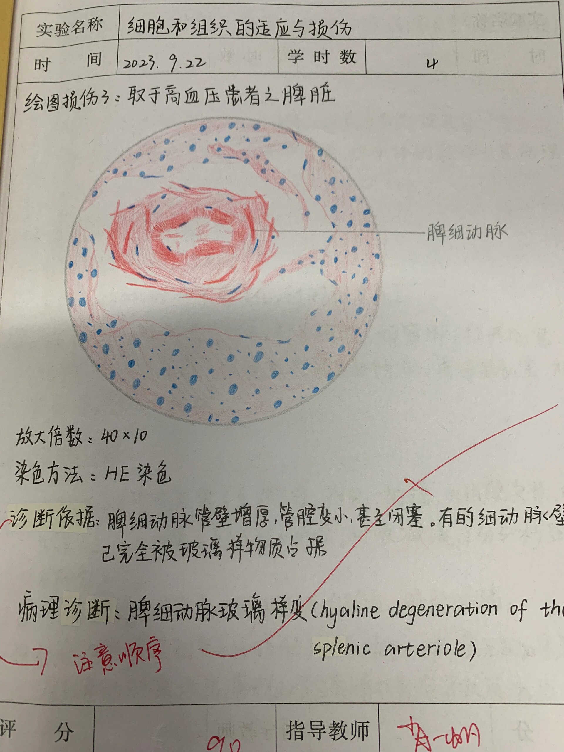 病理学实验 图1 脾细动脉玻璃样变 图2-3局部血液循环障碍(家兔空气