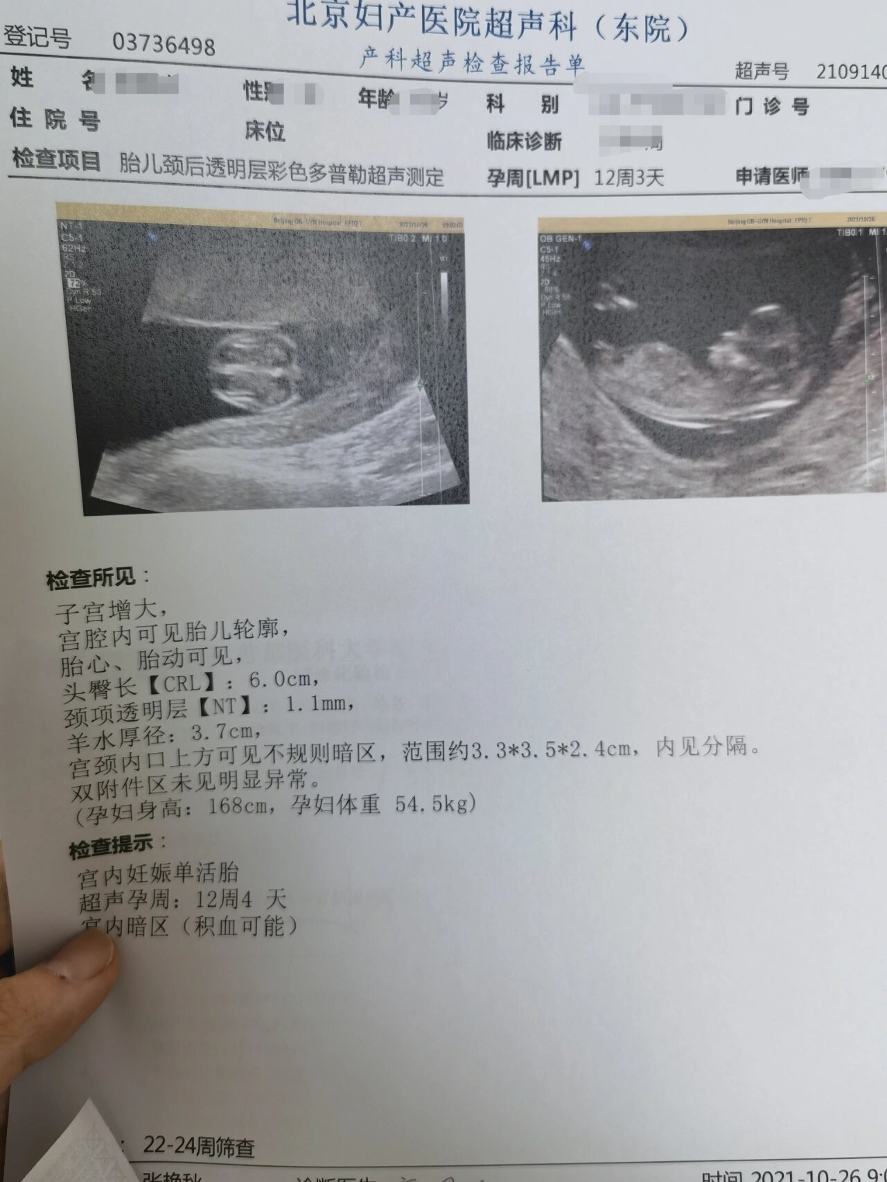 12周nt秒过,明年5月的虎宝宝.