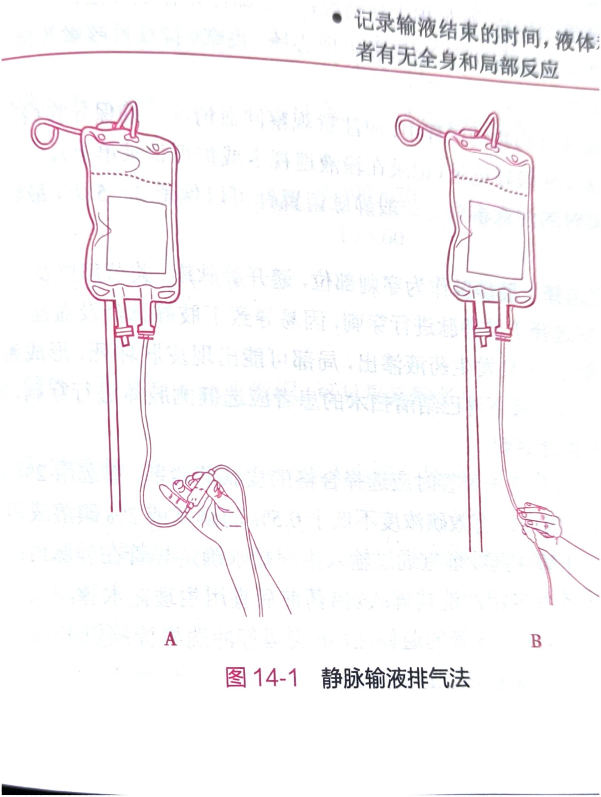 静脉输液实验报告