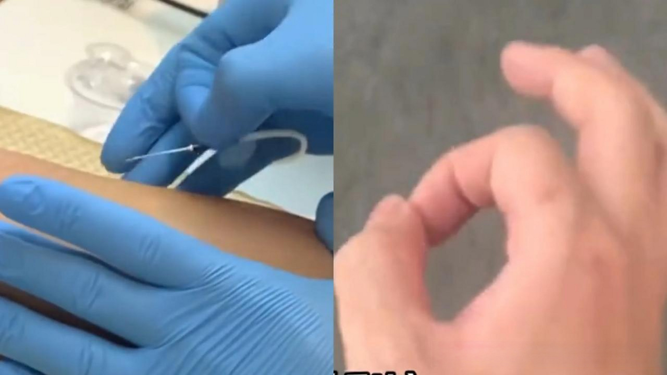 无痛飞针采血技术"练了3万次才敢实际操作,能给病人减轻痛苦】11月2日