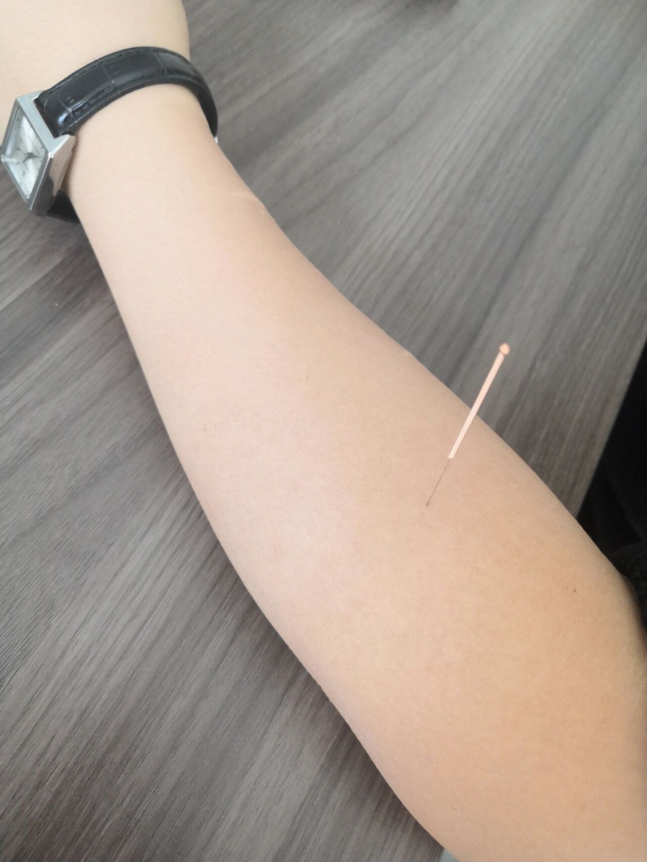 手臂上手太阴肺经的孔最穴,是肺经的郄穴,消炎,镇痛的作用,也是痔疮