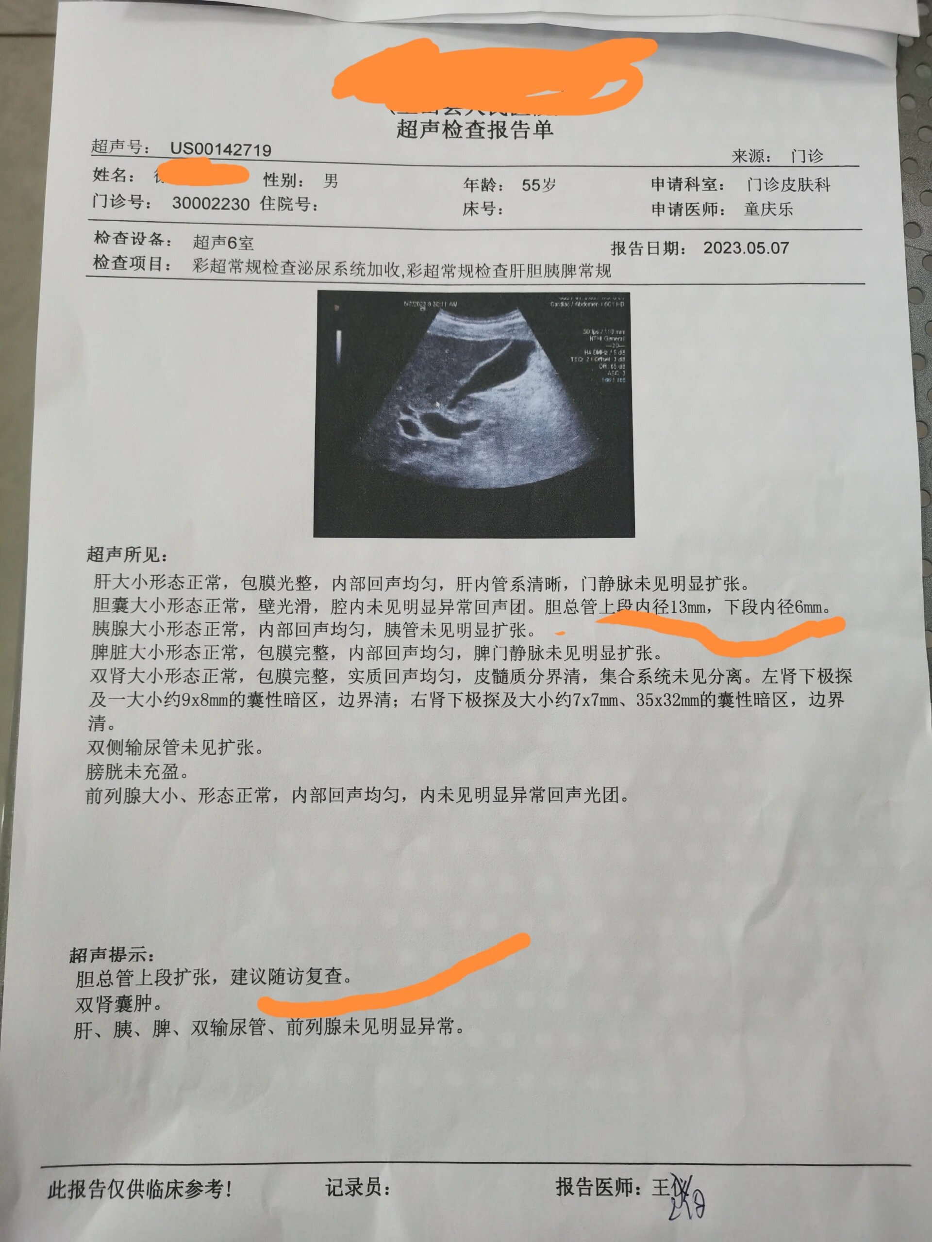 胆总管上段扩张 给医生看了,问了下这个严重不严重也讲不清楚说事什么