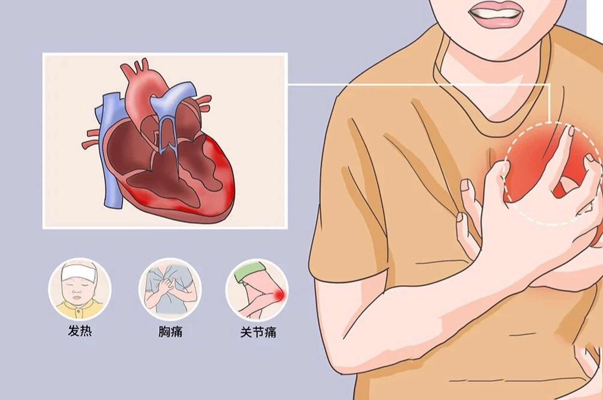 心肌位置图片图片