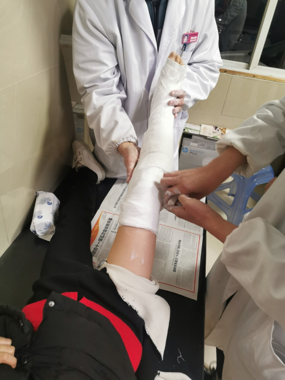 小朋友小腿骨折了 汽车司机突然变道,对方全责,小朋友小腿被撞骨折了