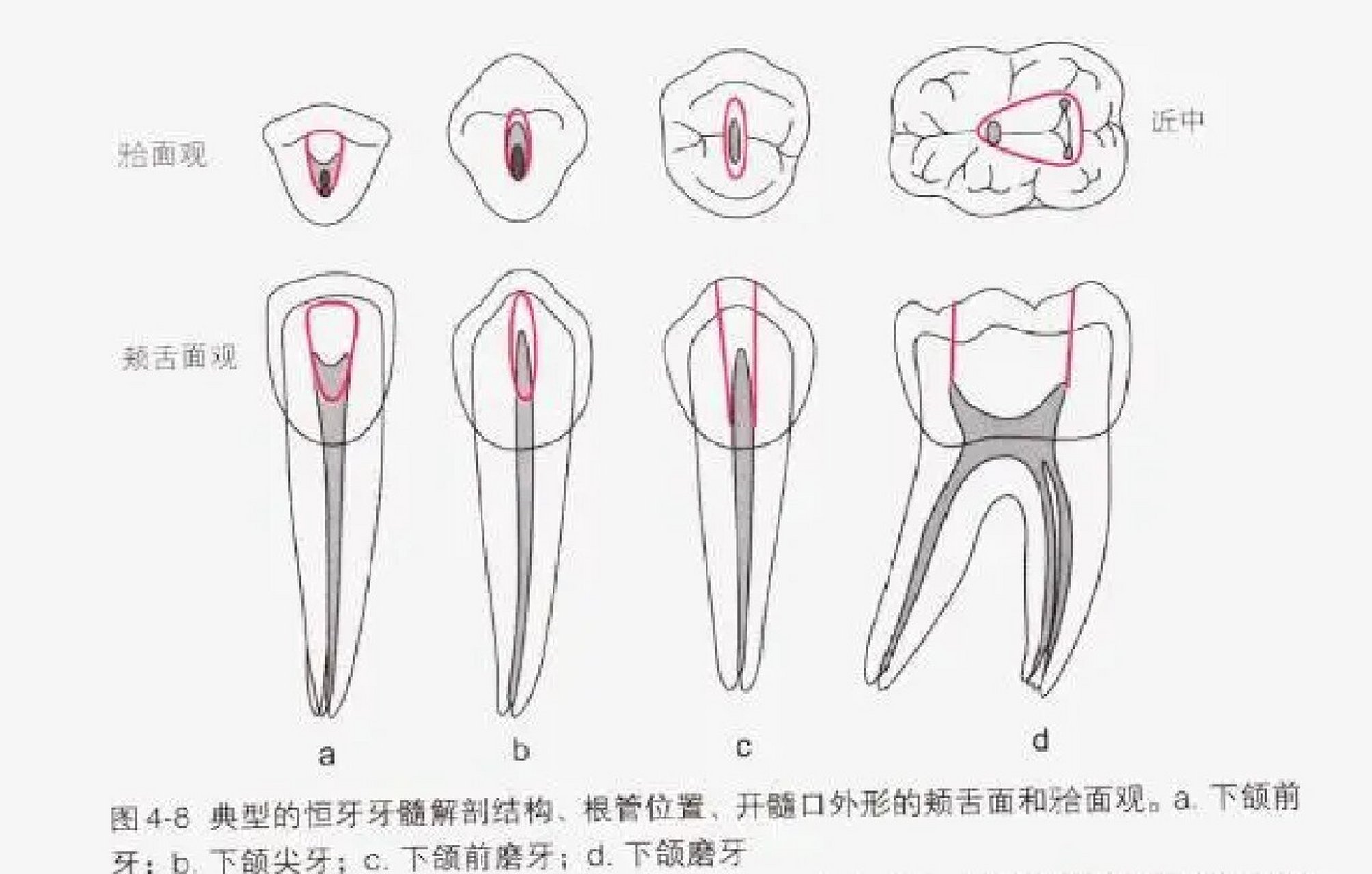 口腔开髓位置图图片