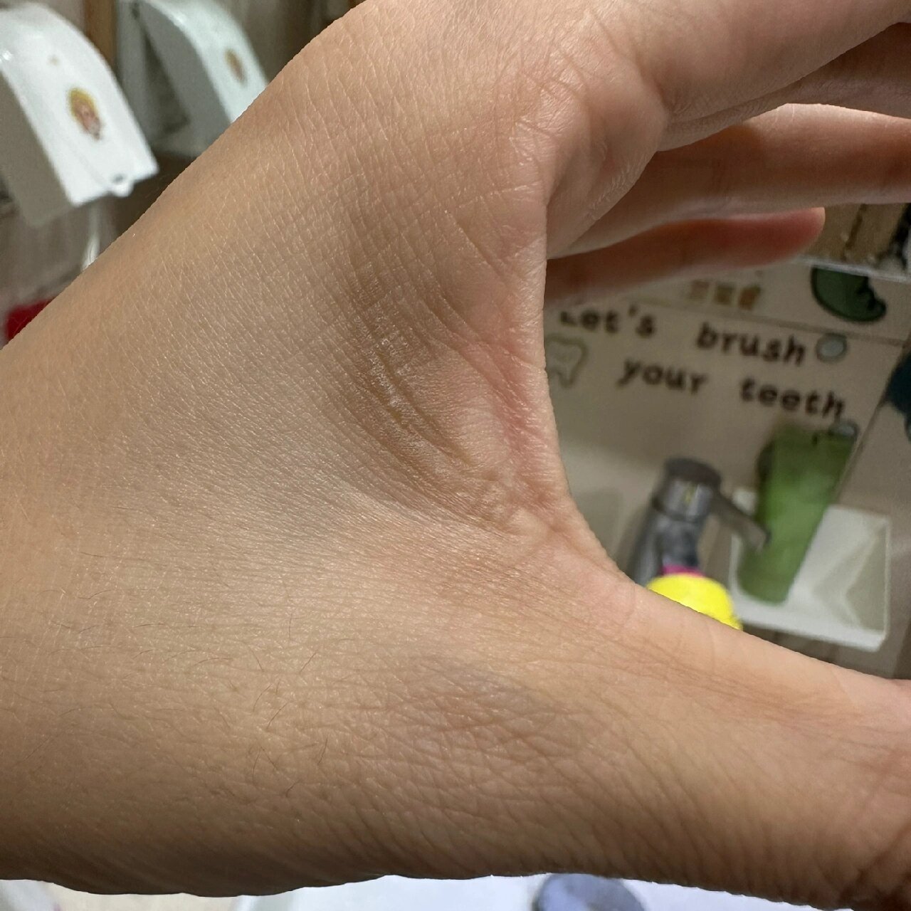 左手虎口发黑啥情况 右手就正常 只有左手 这一块发黑且粗糙