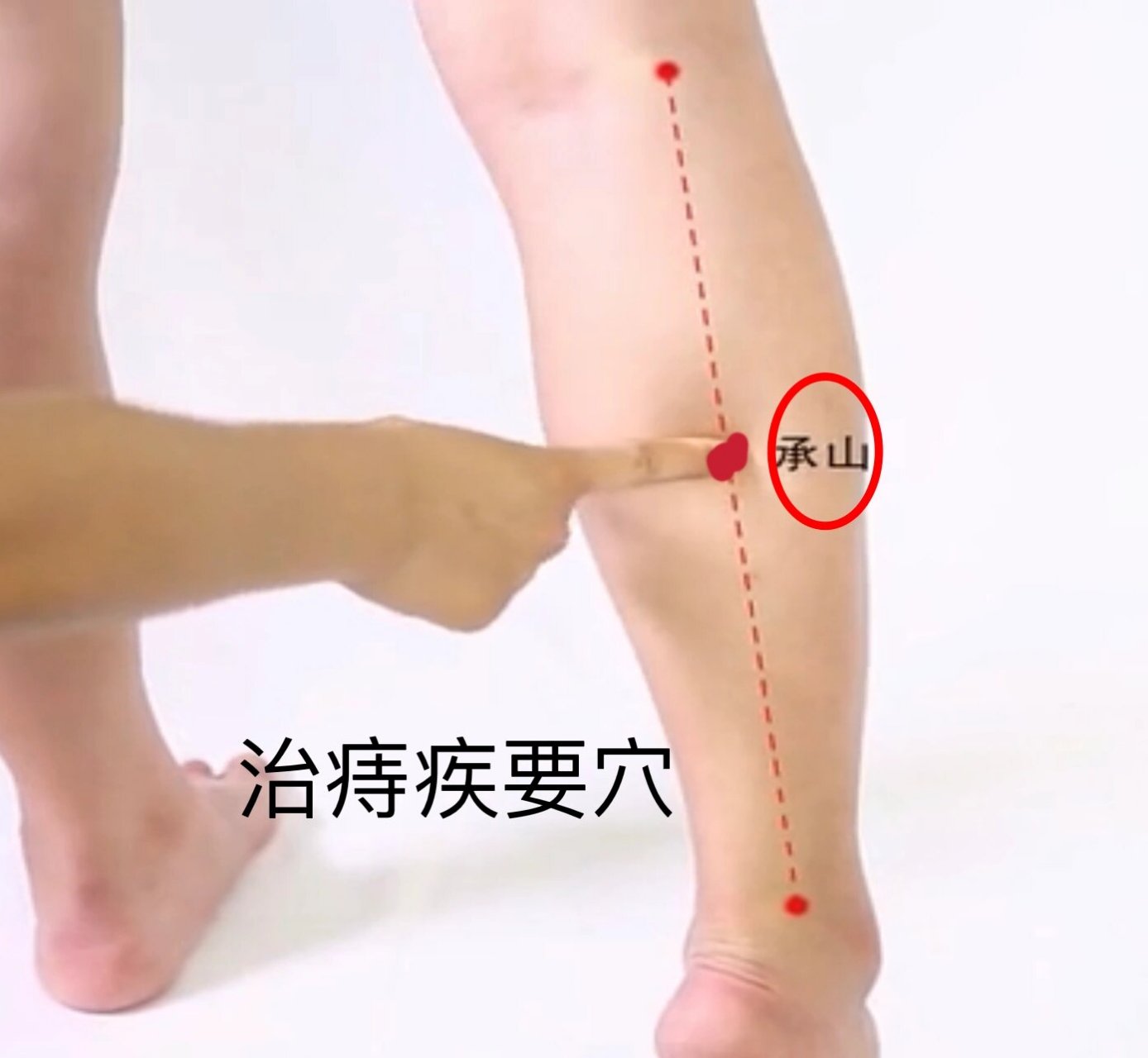 一天记一个穴位—承山 承山穴,属足太阳膀胱经.治痔疾的要穴.