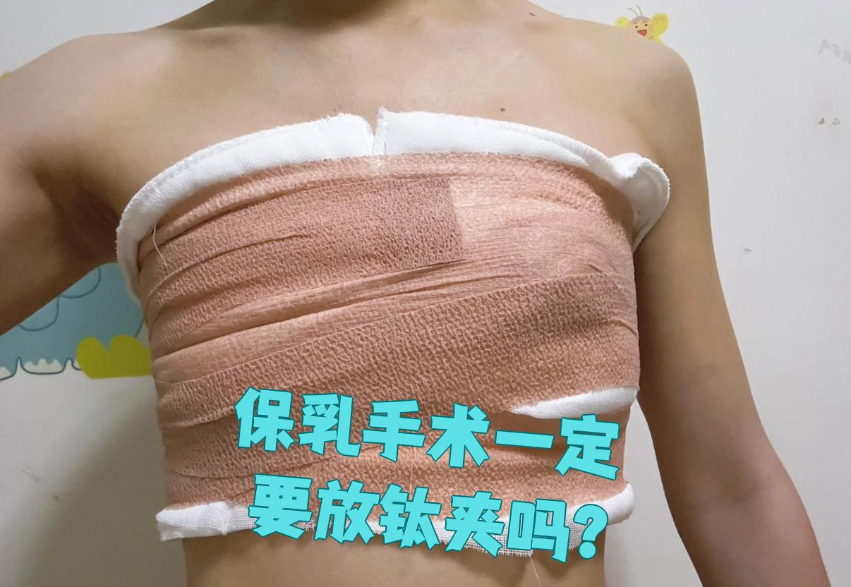 这种手术是治疗乳腺疾病的重要方法,它能保留乳房组织同时切除病灶