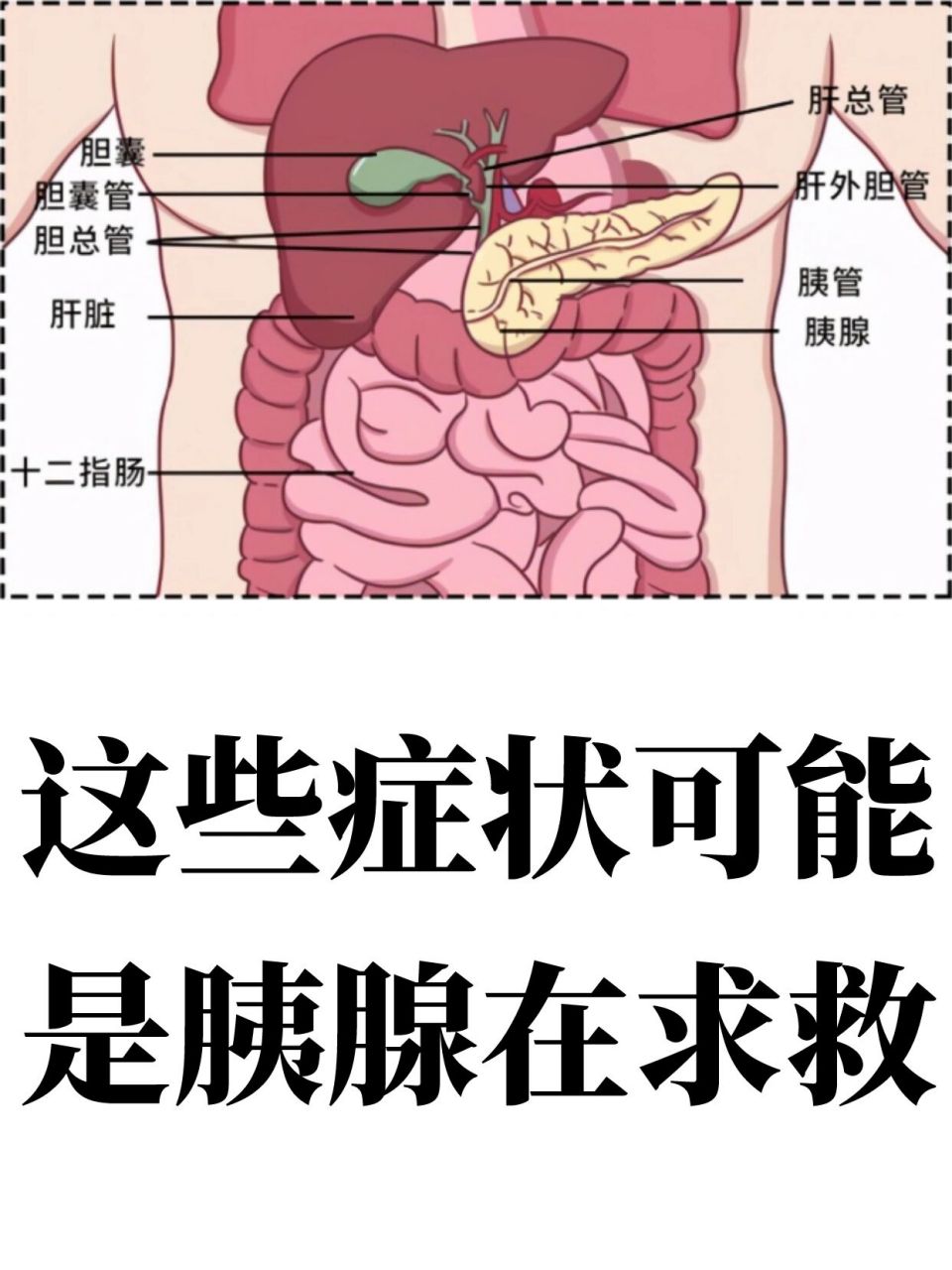 胰腺癌初期可能出现这些症状,不要掉以轻心 胰腺癌,又被称为"癌王"