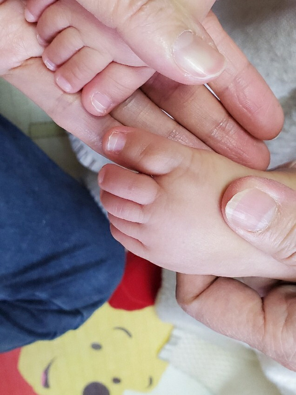 婴儿指甲分层初期图片图片