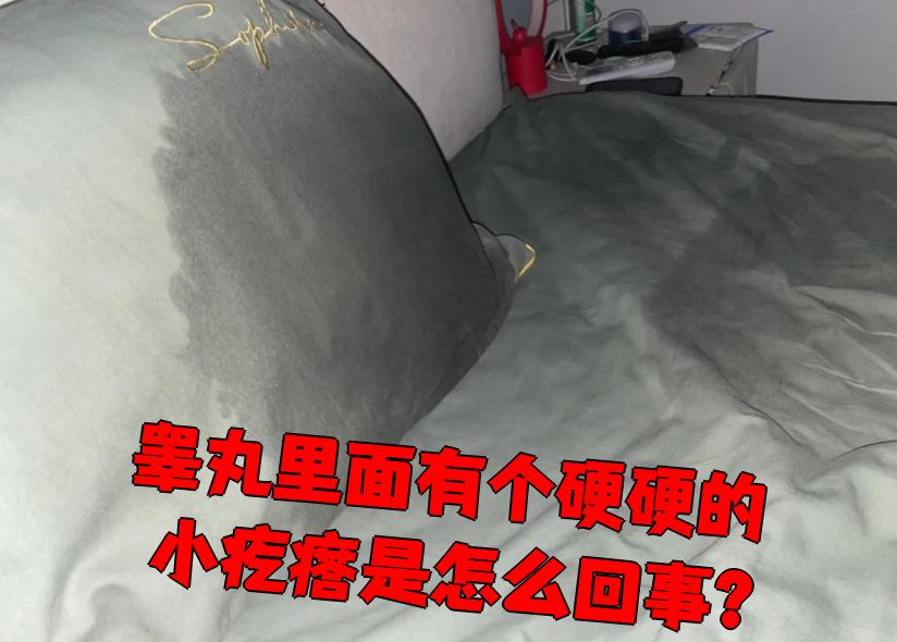 睾丸里面摸到硬硬的小疙瘩,常见原因有炎性结节,结核和肿瘤