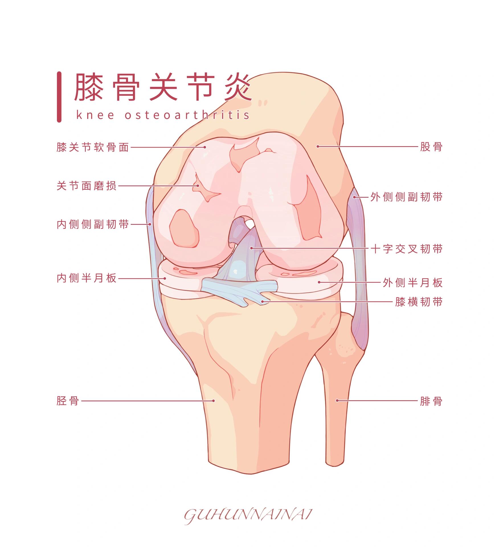 4～膝骨关节炎 第三周作业打卡来啦～ 图源|一目可视 	 膝骨关节炎