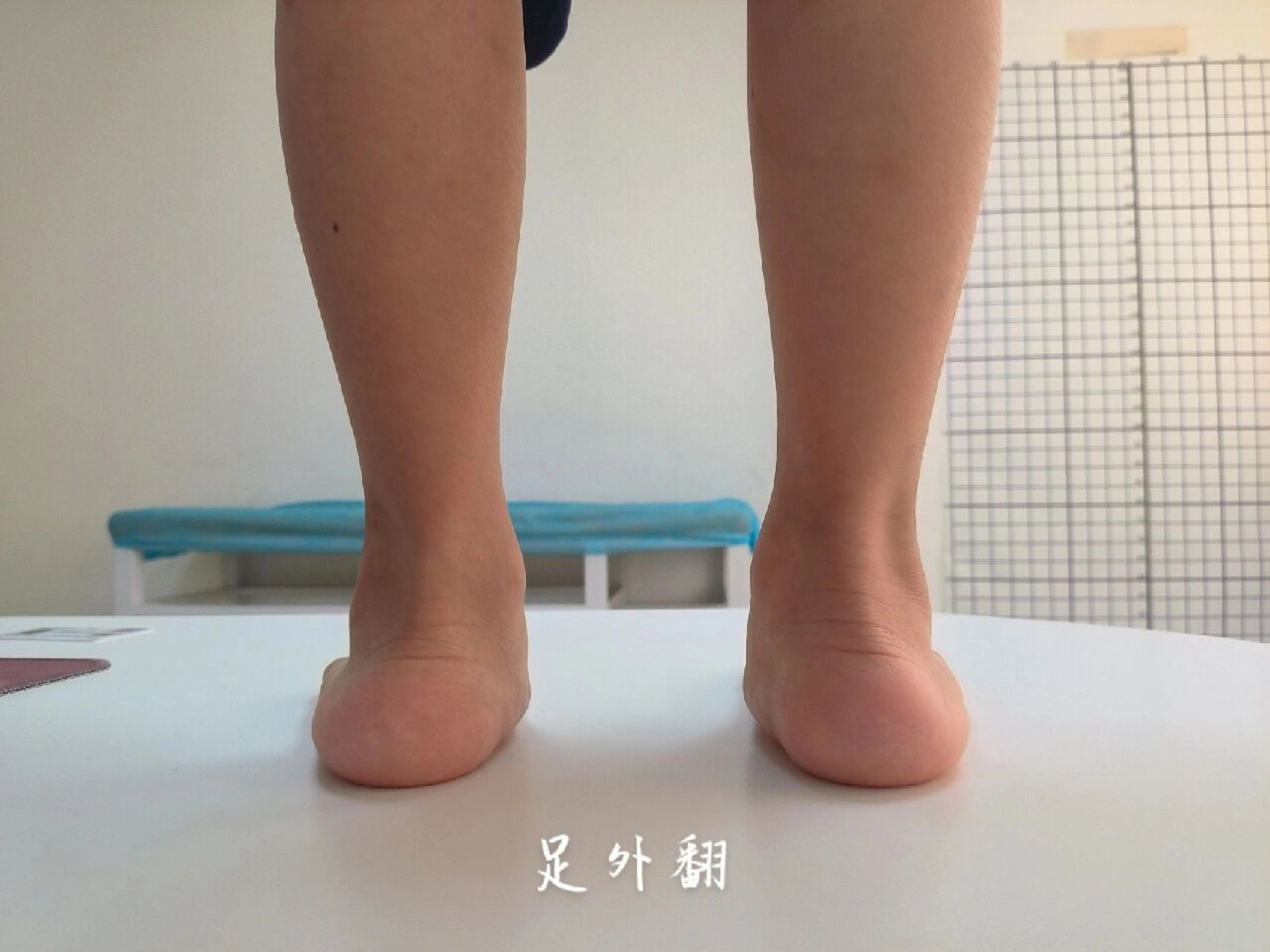 足内翻和足外翻 经常会有家长带小朋友来看脚的外观,描述的不准确.