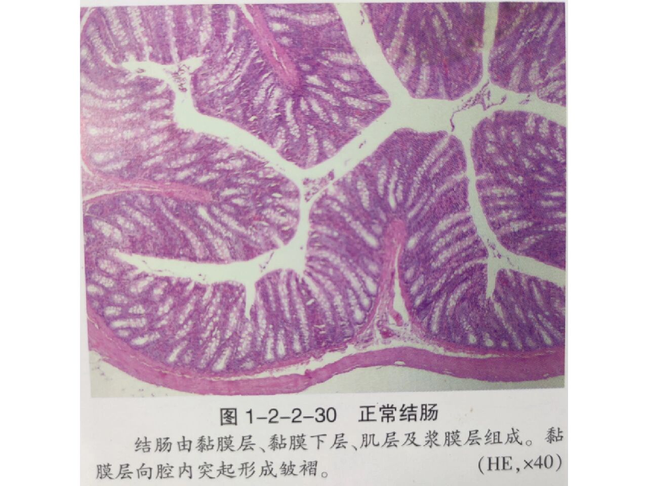 消化管结肠he染色辨别