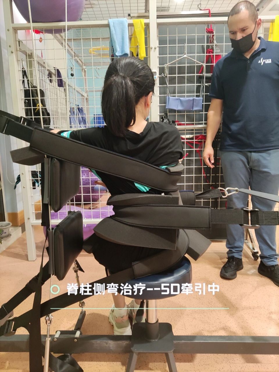 12岁女孩脊柱侧弯矫正治疗 这是一位12岁脊柱侧弯的小姑娘,之前尝试过