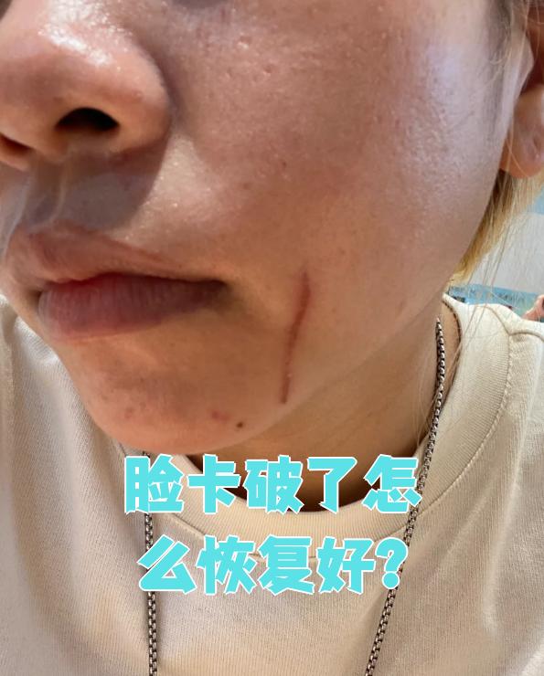 如果只是轻微破皮,面积不大,伤口很浅,没有流血或只有一点点疼,一般