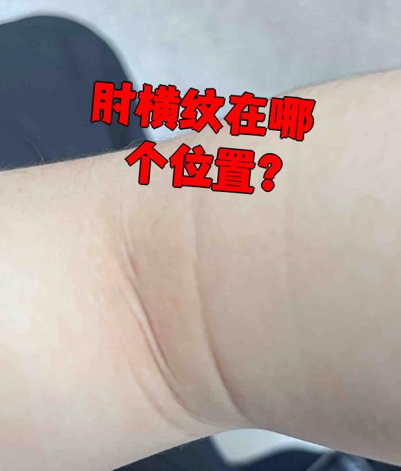 肘横纹就是胳膊弯曲时肘关节前面那条明显的横线