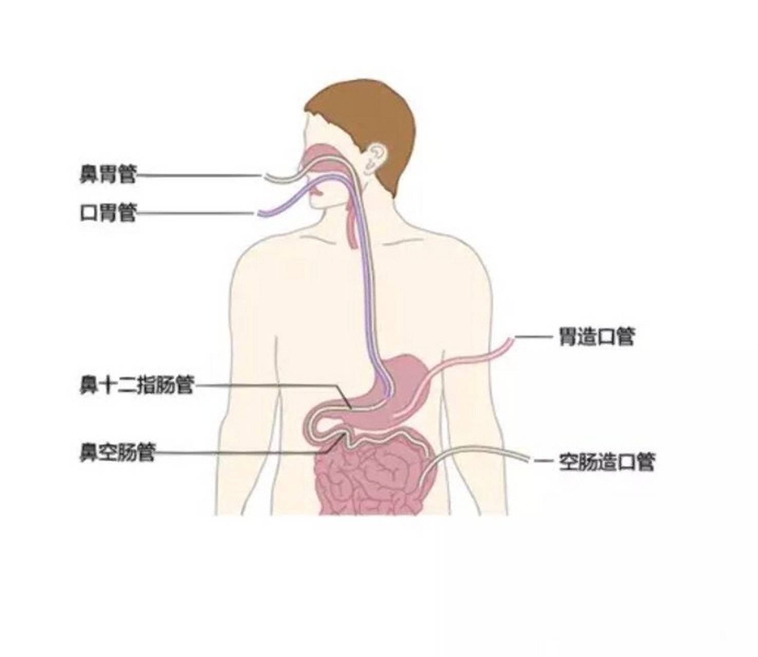 胃管在鼻腔的解剖图图片