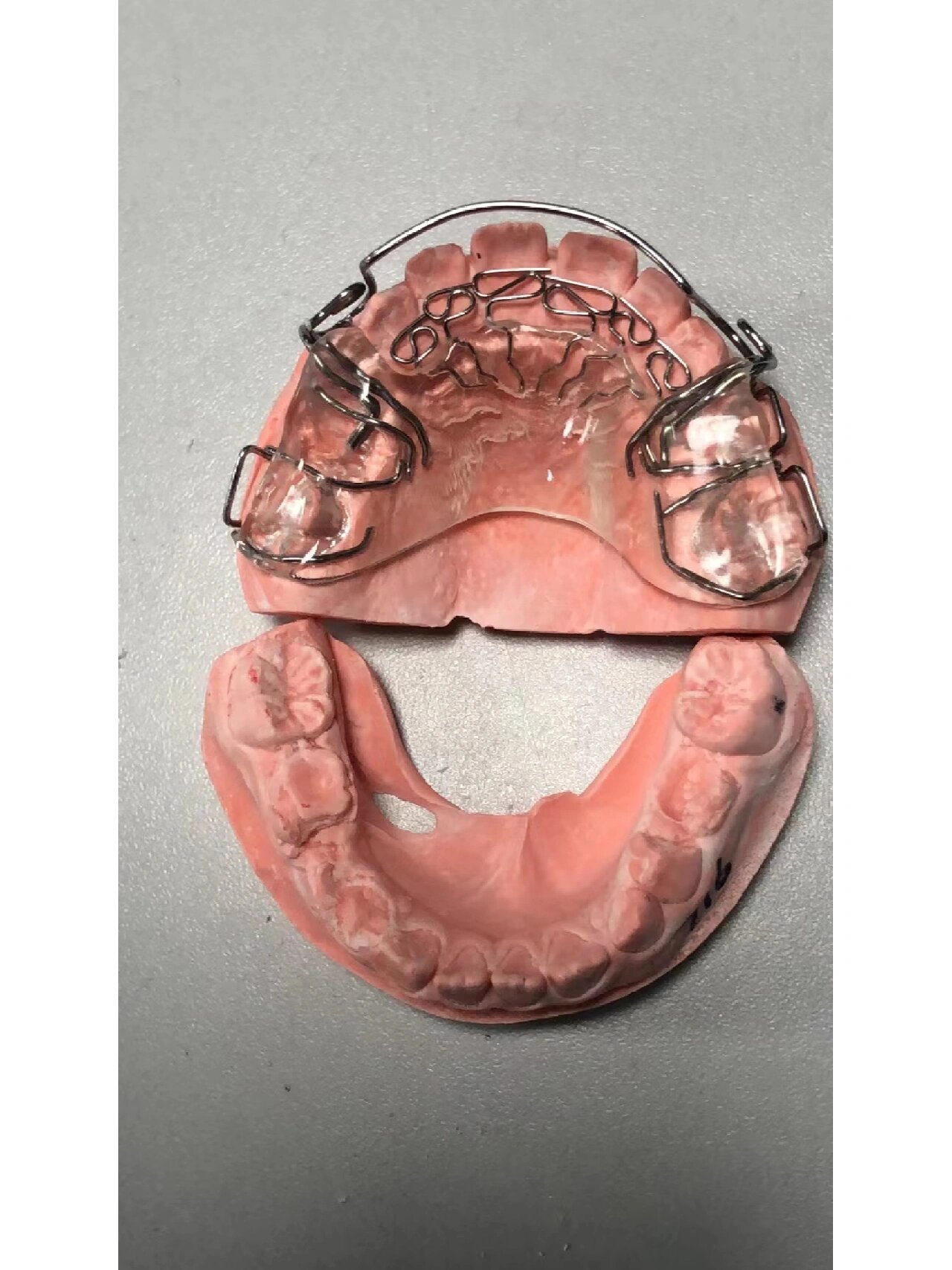 矫治器 导弓 舌簧 牵引