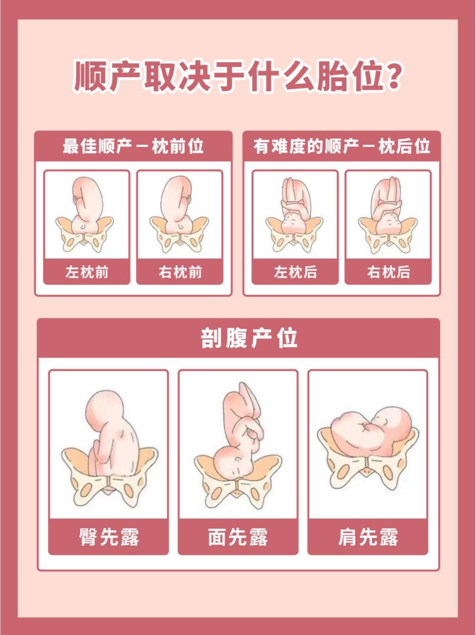 是顺产胎位么 今天小喜给各位准妈妈们聊一聊胎位的干货.