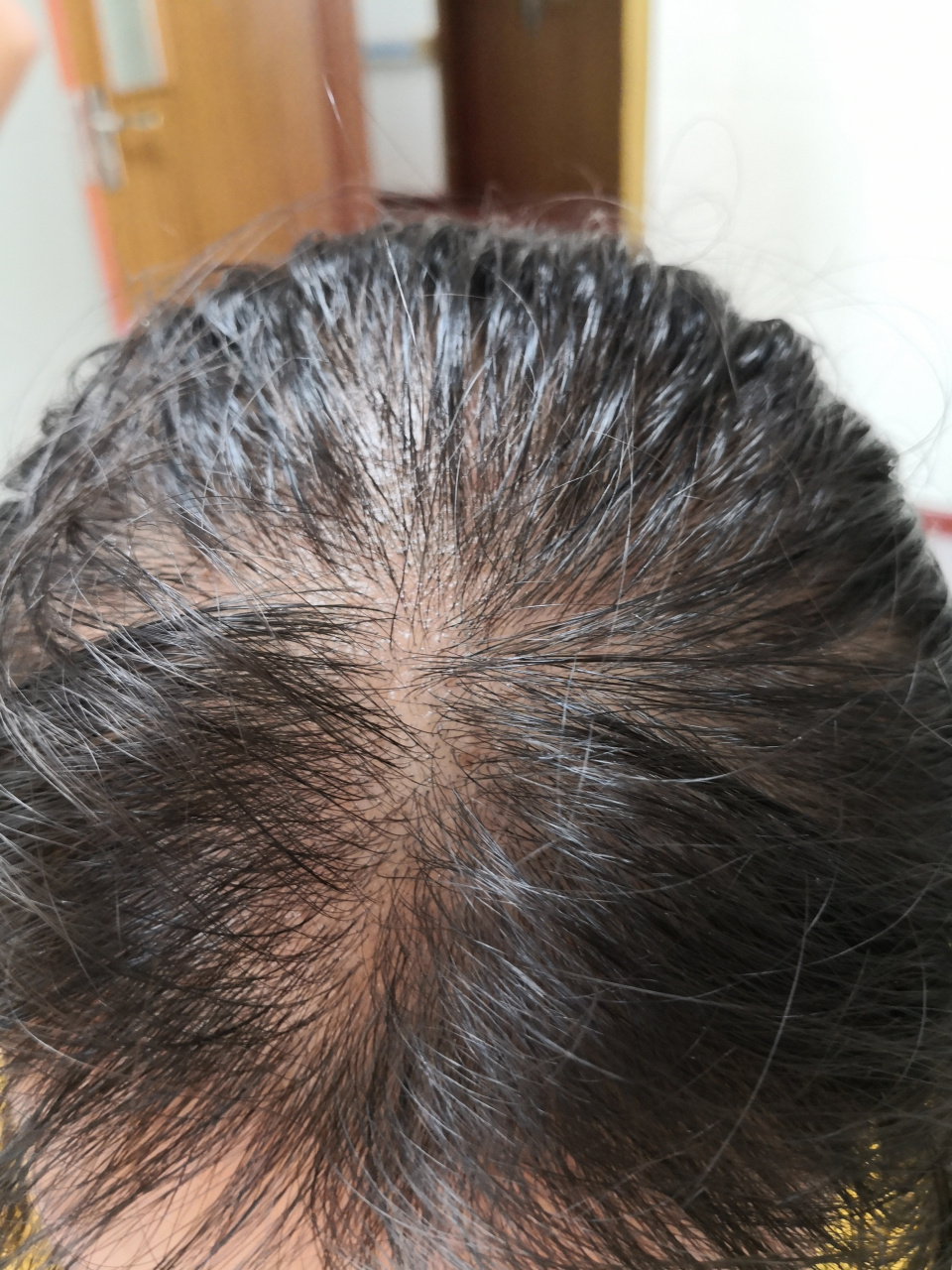 解决皮肤问题专注皮肤美容##脱发##雄激素性脱发