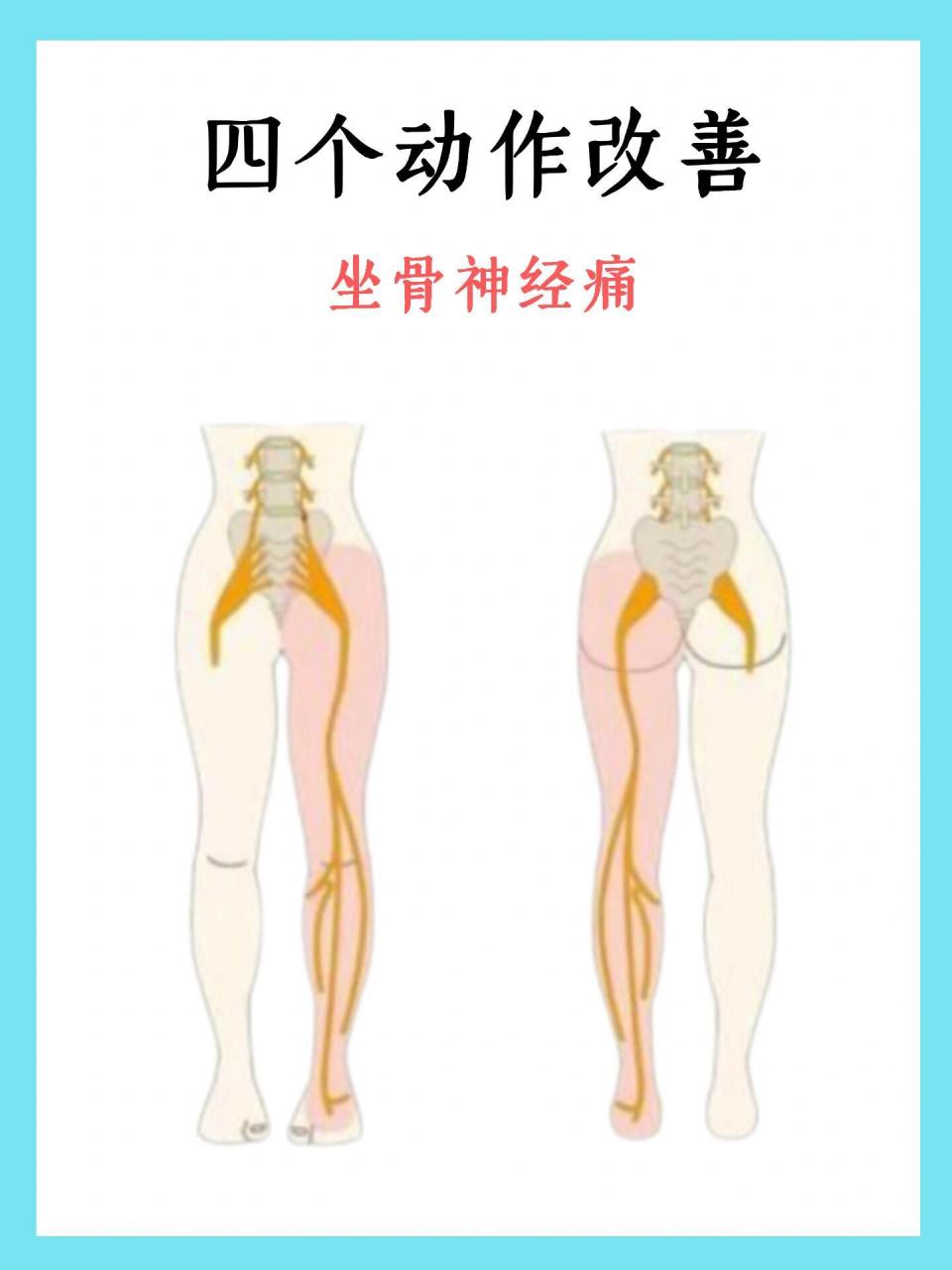改善坐骨神经痛的几个动作 很多办公族总说腰疼屁股疼腿麻 经常坐也不