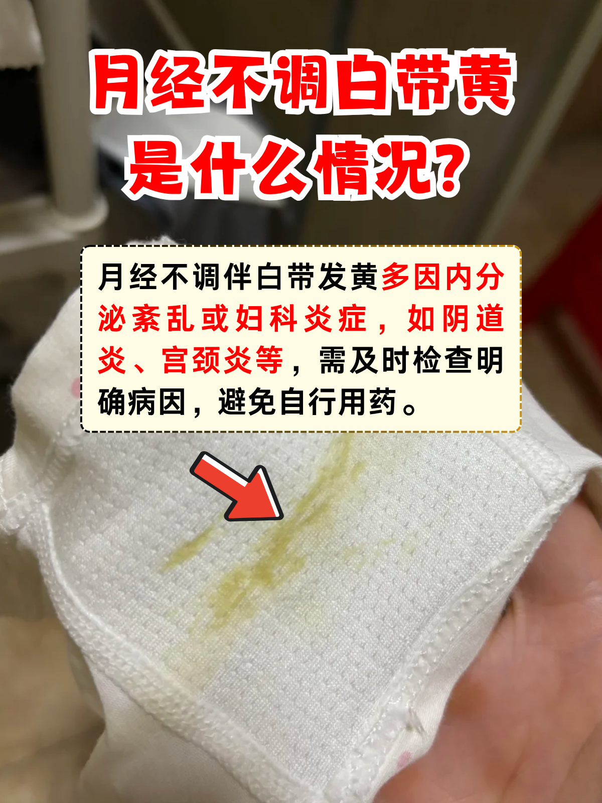月经不调伴随白带发黄,可能是多种因素共同作用的结果,需引起重视