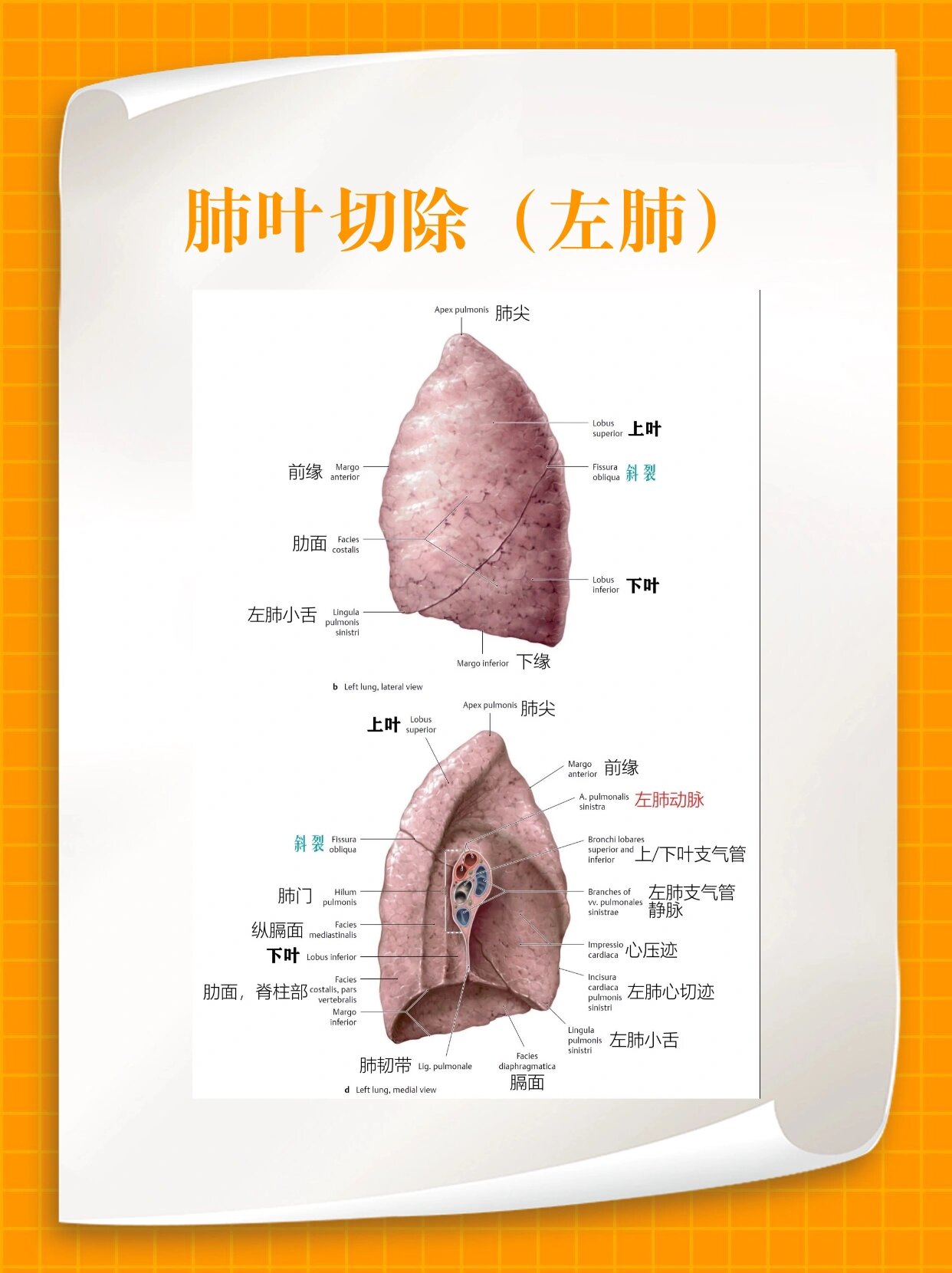 楔形切除,肺段切除,肺叶切除都是啥意思?