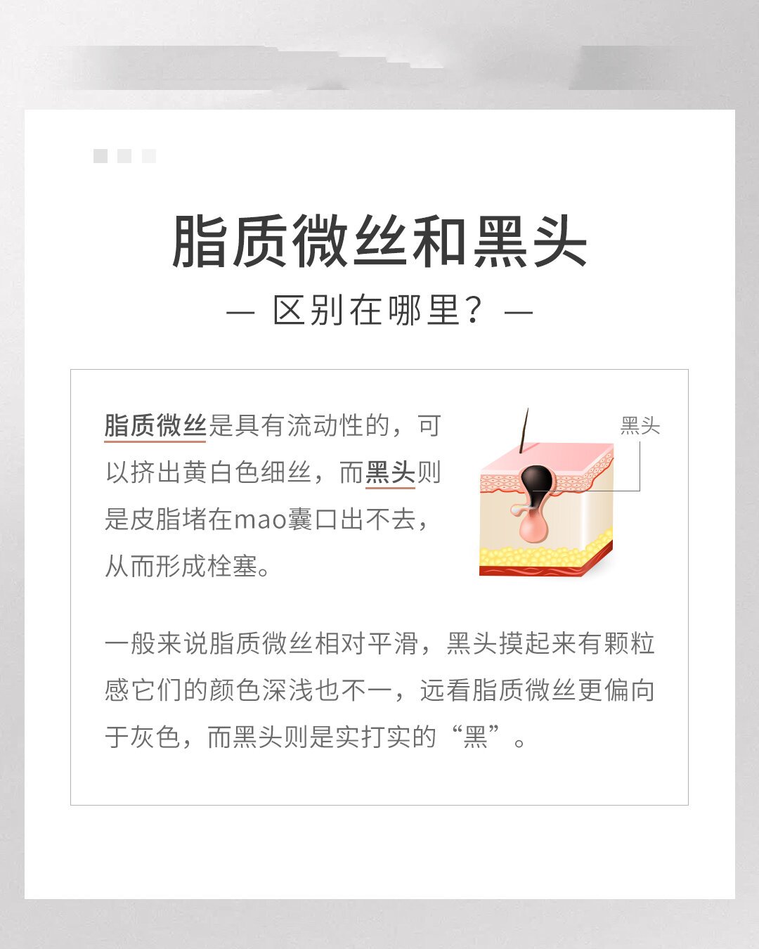 鼻子上的"白丝丝"～脂质微丝,不是黑头!