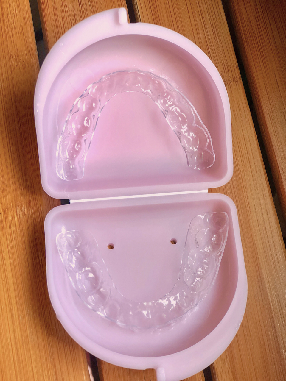 拆牙套后戴维持器(保持器)注意事项 戴了两年十个月的陶瓷牙套,这个月