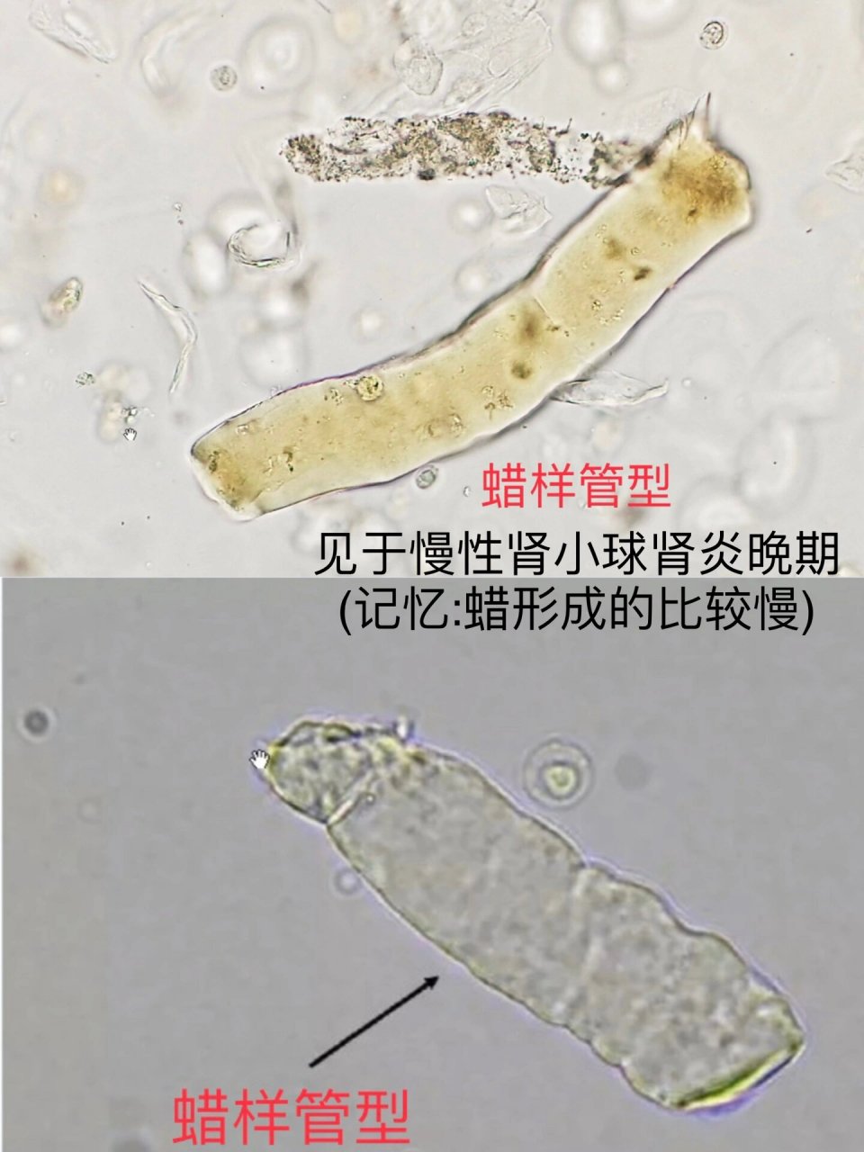 犬尿沉渣管型图片