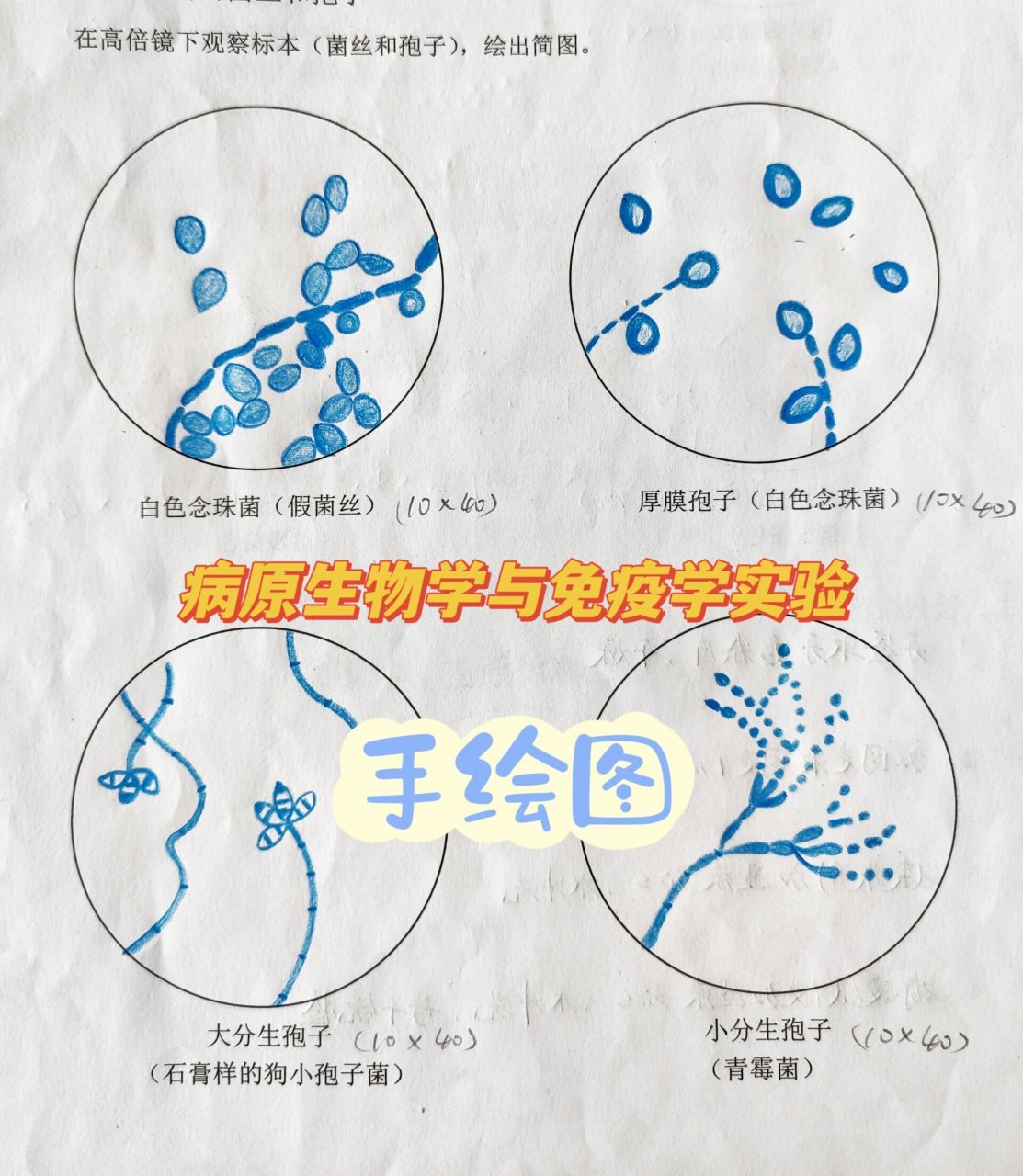 奋森氏螺旋体手绘图图片