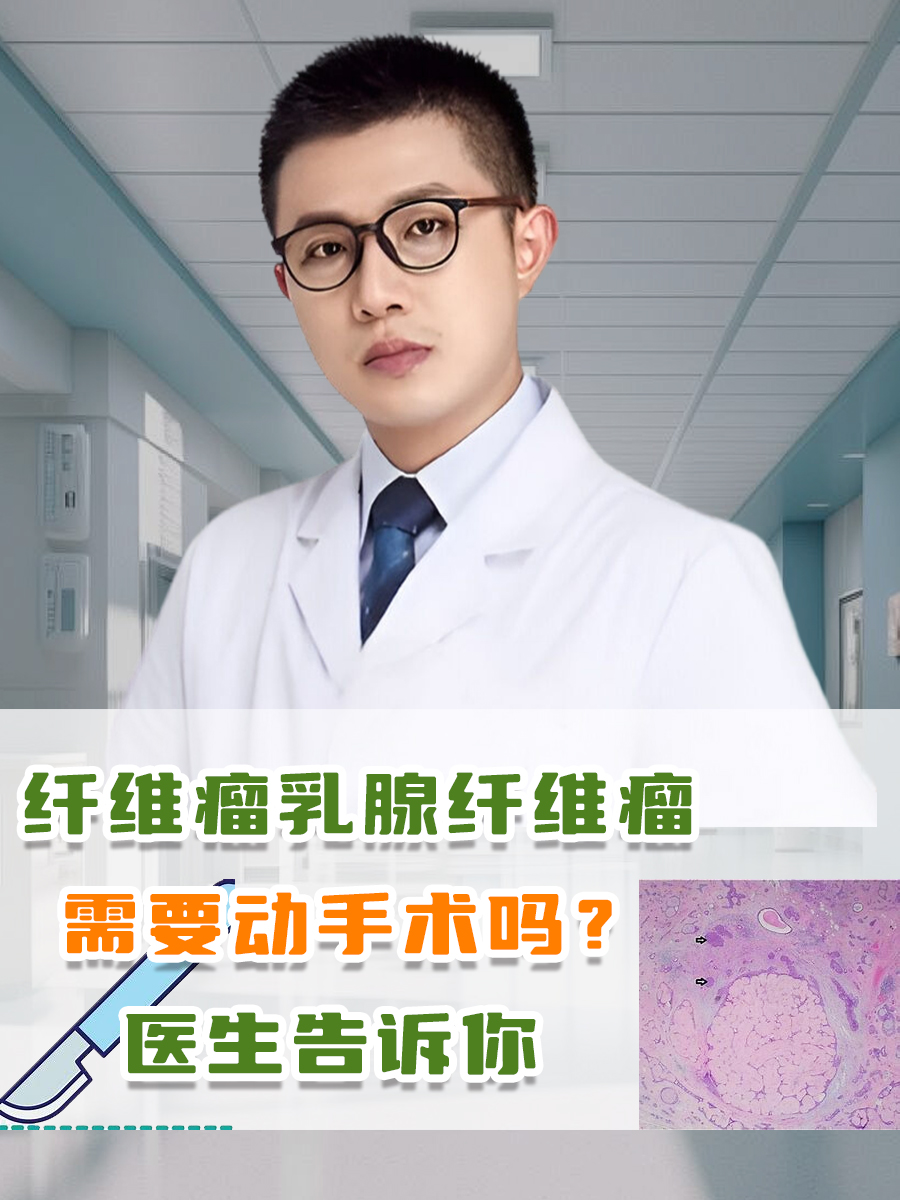 纤维瘤乳腺纤维瘤需要动手术吗?