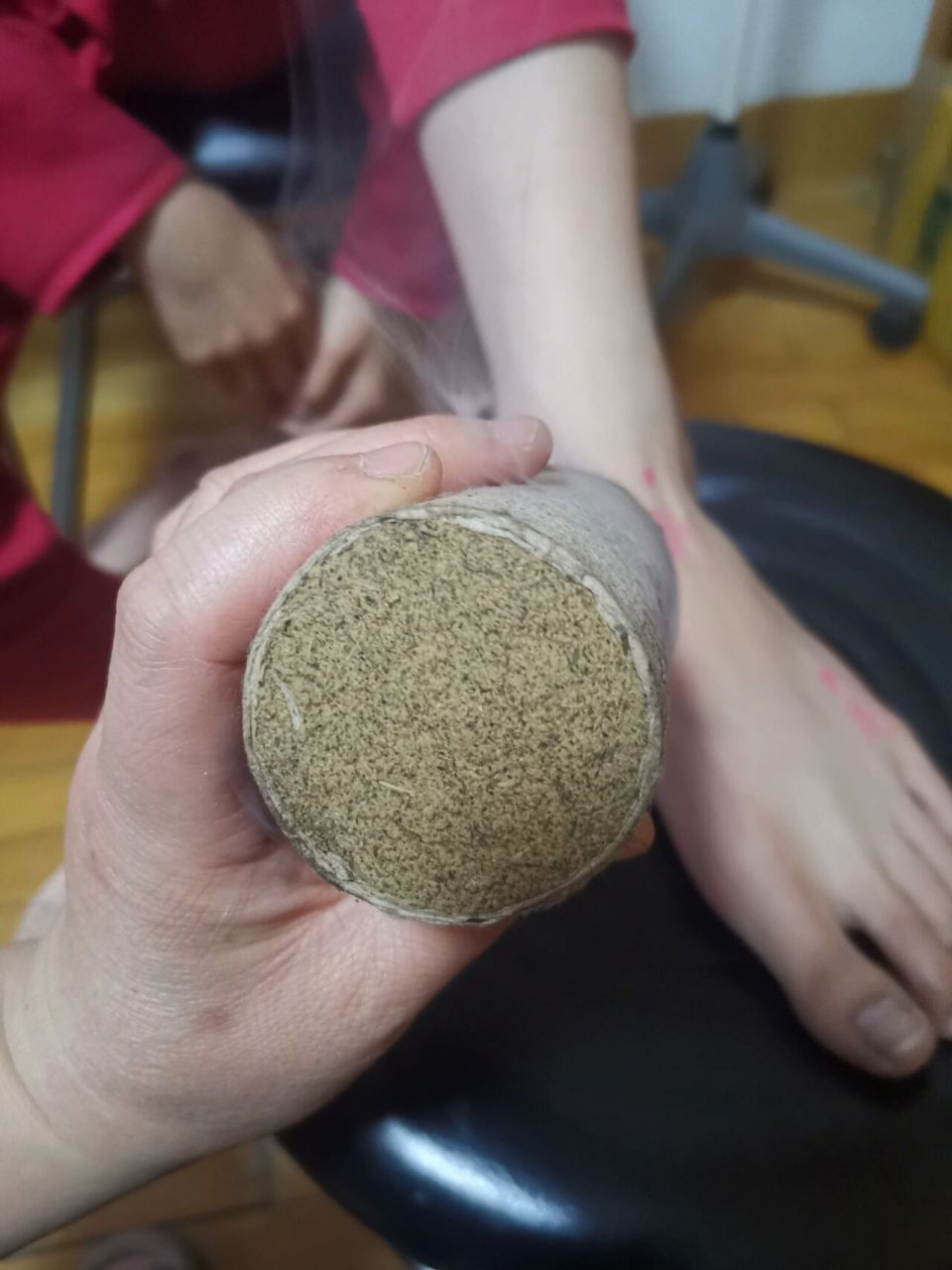 姑娘脚崴着以后,用粗的艾条去每天给她灸,效果很好