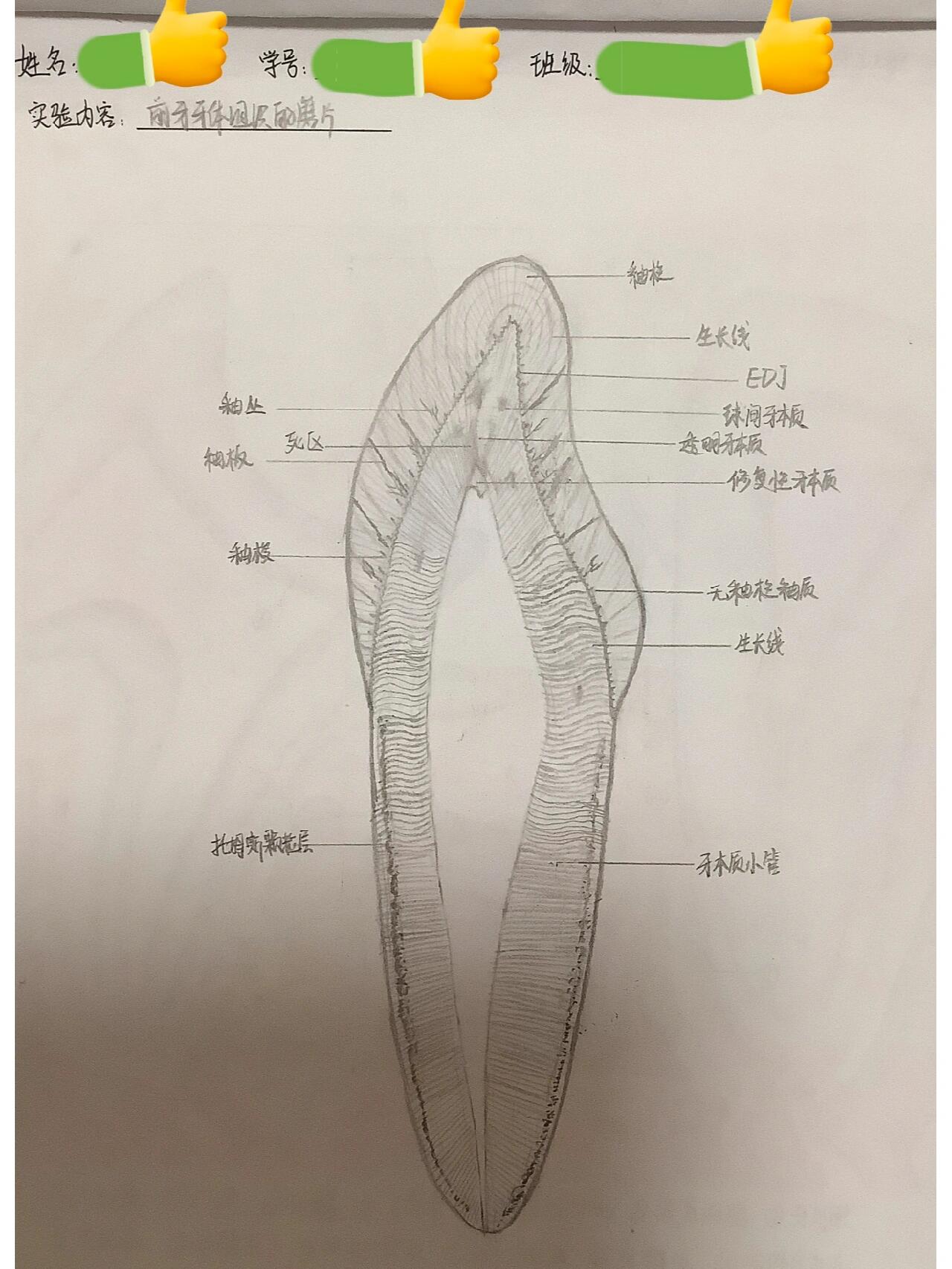 牙本质绘图图片