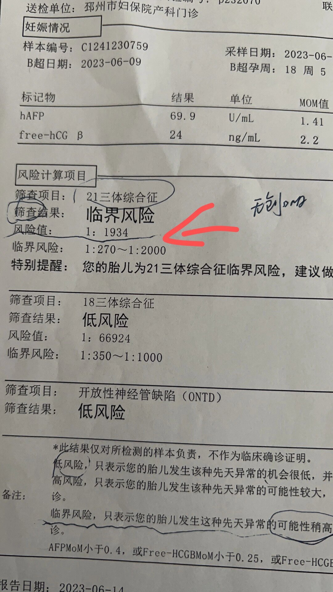 唐筛显示21三体综合征是临界风险很担心,所以下午做了无创医生说10天