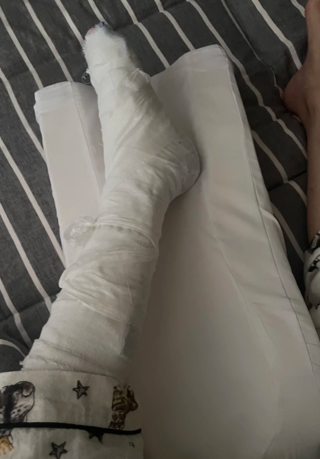 第一种情况是卫生问题.骨折后如果长时间不洗澡,或者打了石膏固定