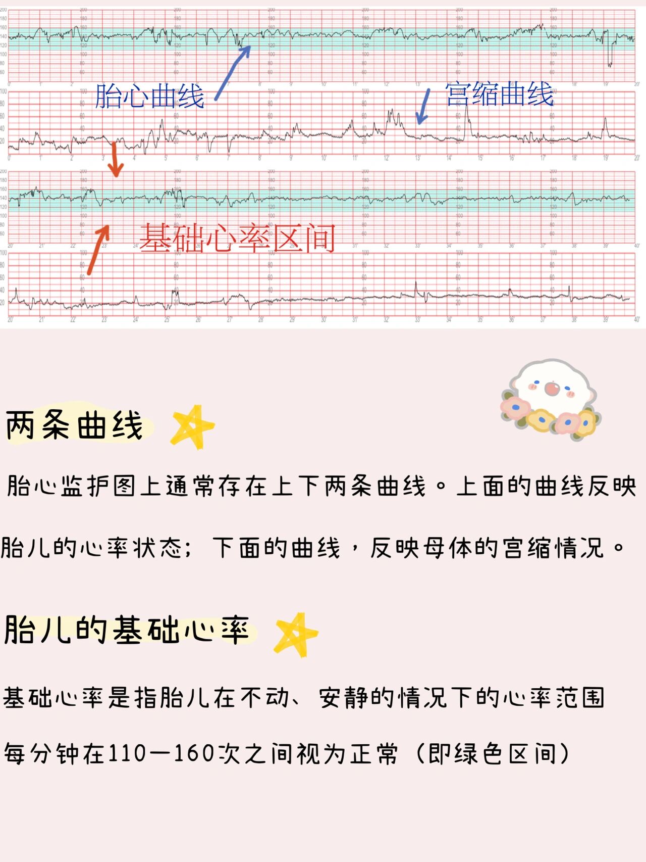 胎儿心率突然大减速,被评为不合格,在医院吸氧并且租了胎心监护仪