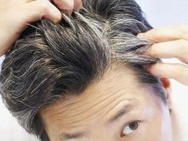 年轻人有白头发是肾不好么?