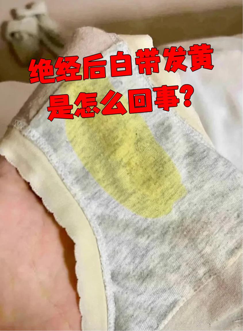 绝经后白带发黄可能是萎缩性阴道炎,滴虫性阴道炎或外阴阴道假丝