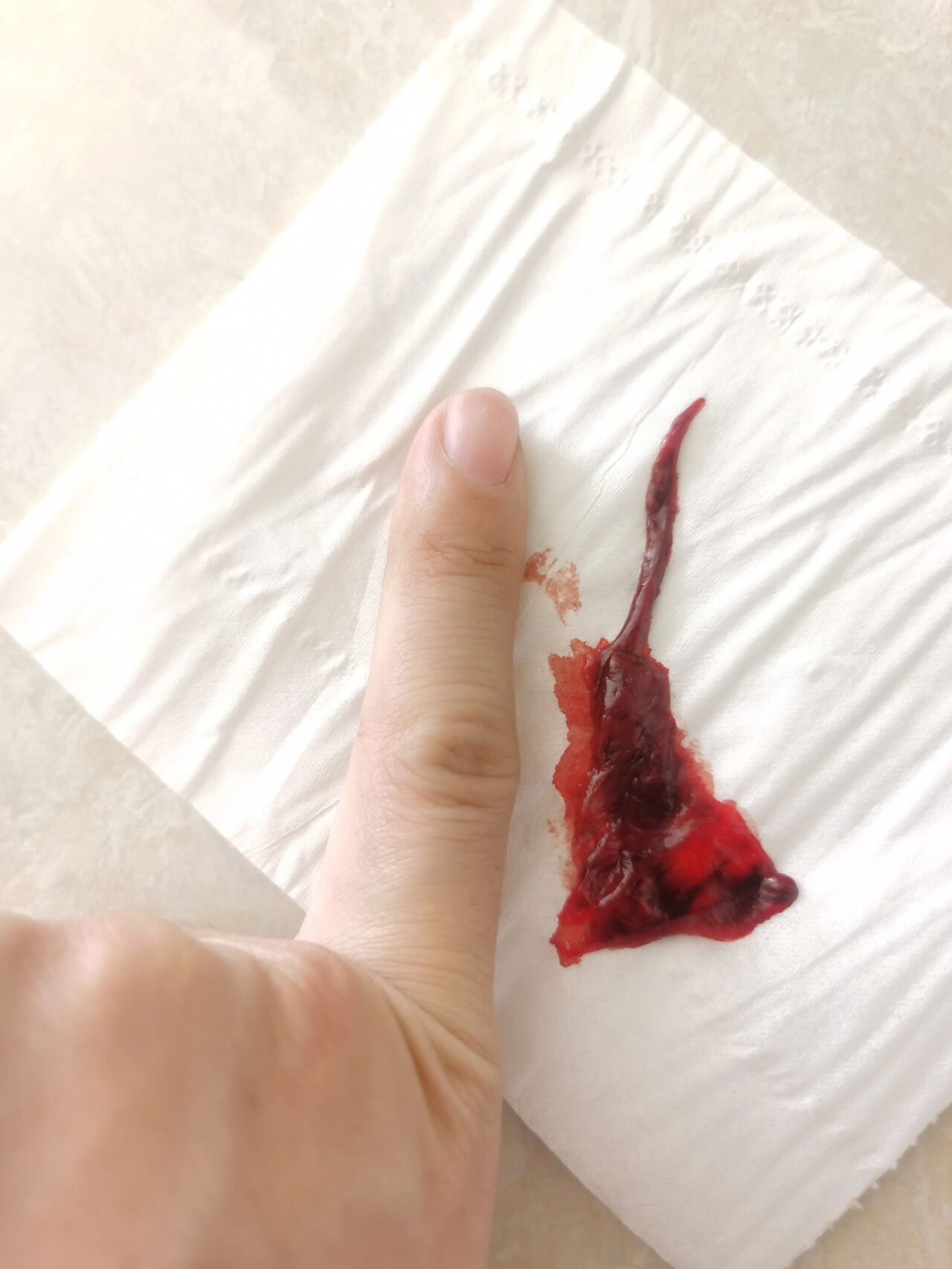 生化妊娠也会出现血hcg短期内正常翻倍