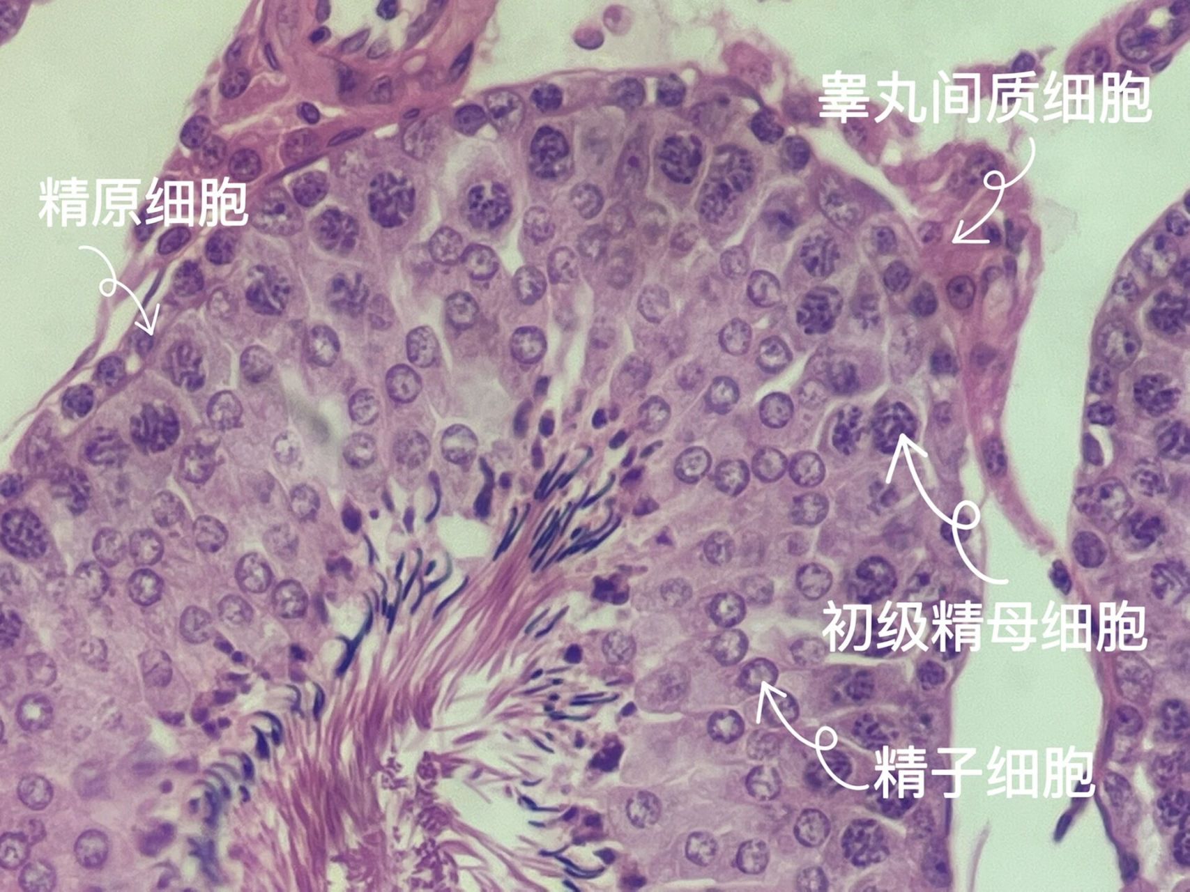 睾丸与卵巢切片 图一为生精小管 图二为次级卵泡 图三为原始卵泡 图四