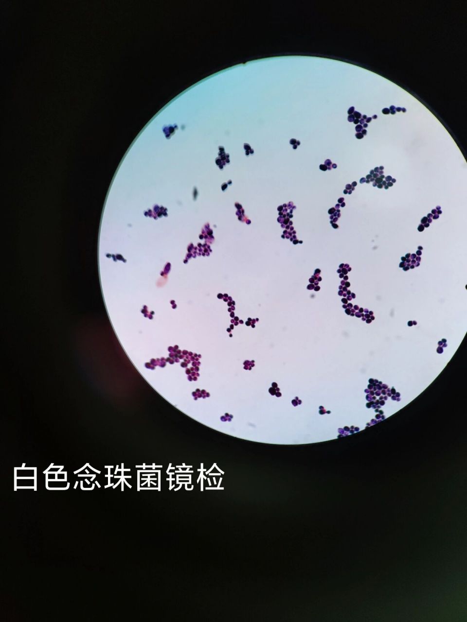白色念珠菌,镜检图片,原来显微镜下白念菌这样子的,革兰氏阳性菌