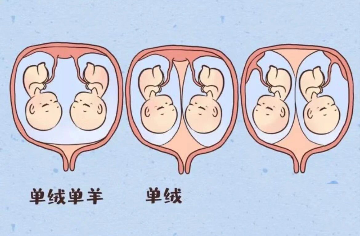 单绒单羊双胞胎