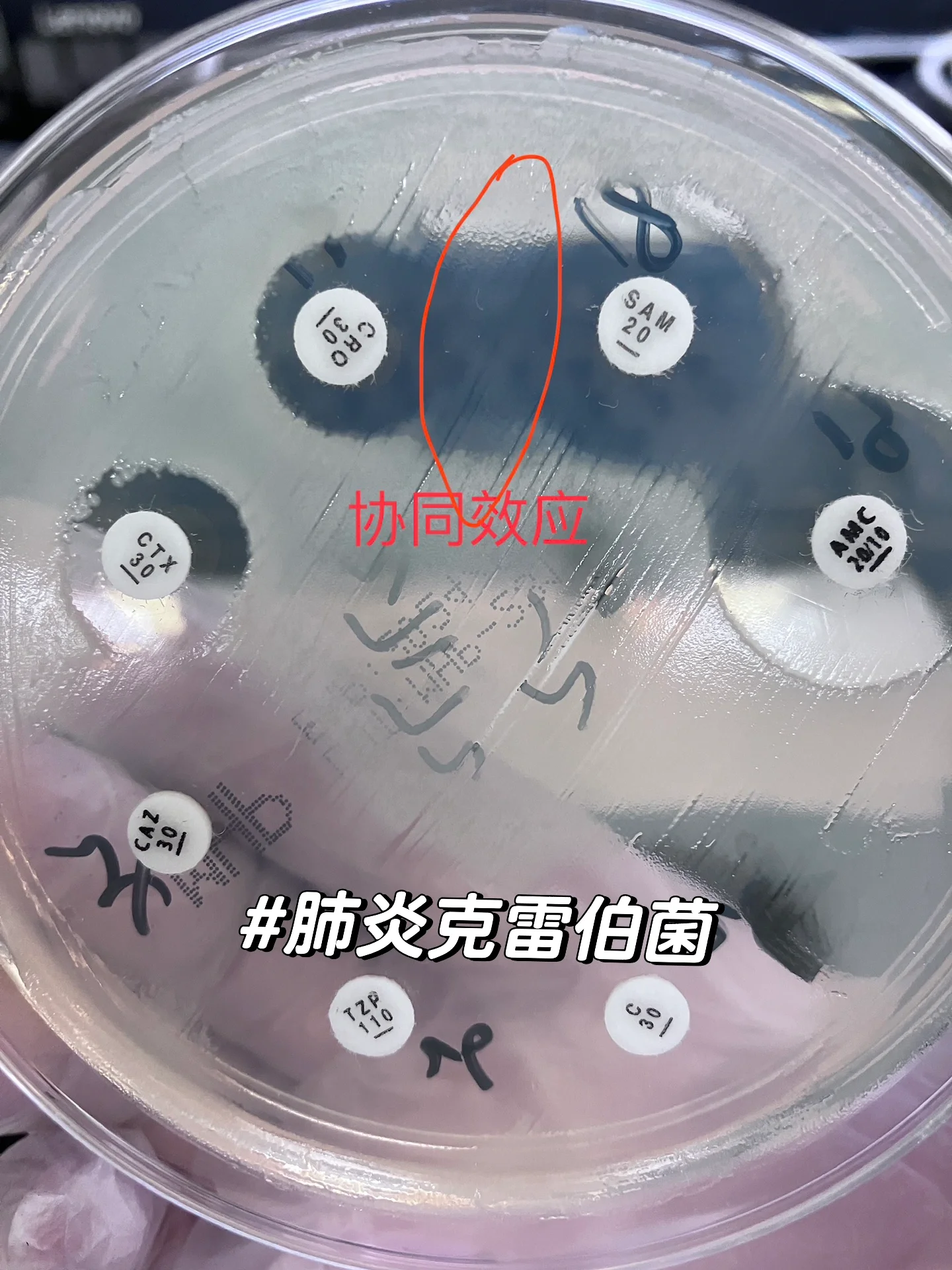 esbls产超广谱β内酰胺酶 超广谱β内酰胺酶是指水解头孢曲松,头孢噻